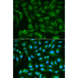 Sorbitol Dehydrogenase (SORD) Antibody