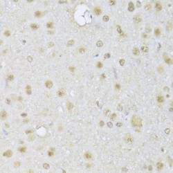 Histone Deacetylase 3 (HDAC3) Antibody