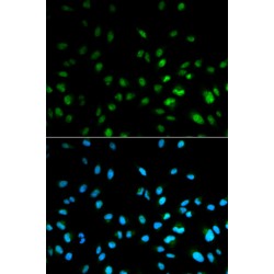 Histone Deacetylase 3 (HDAC3) Antibody