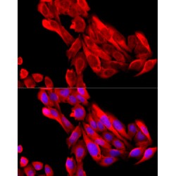 Natriuretic Peptides B (NPPB) Antibody