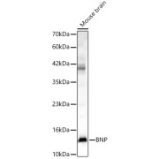 Western blot analysis of Mouse brain, using NPPB antibody (1/2000 dilution).