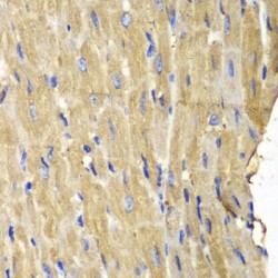 Phospholipase C Gamma 2, Phosphatidylinositol Specific (PLCG2) Antibody