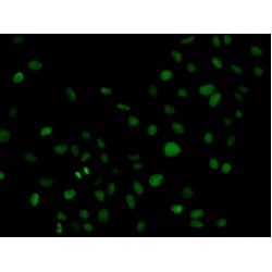 Phospholipase C Gamma 2, Phosphatidylinositol Specific (PLCG2) Antibody