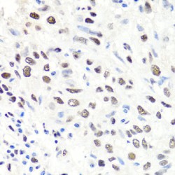 Chromobox Protein Homolog 1 (CBX1) Antibody