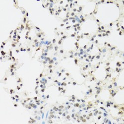 Endothelial Differentiation-Related Factor 1 (EDF1) Antibody