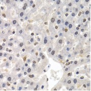 Immunohistochemistry of paraffin-embedded rat liver using GTF2F1 antibody (abx001933) at dilution of 1/200 (40x lens).