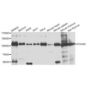 Western blot analysis of extracts of various cell lines, using FOXM1 antibody (abx001937) at 1/1000 dilution.