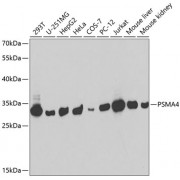 Western blot analysis of extracts of various cell lines using PSMA4 antibody (1/1000 dilution).