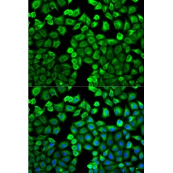 Histamine N-Methyltransferase (HNMT) Antibody