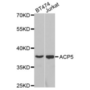 Western blot analysis of extracts of various cell lines, using ACP5 antibody (abx001968) at 1/200 dilution.