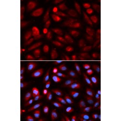 Tartrate-Resistant Acid Phosphatase 5 / TRACP5 (ACP5) Antibody