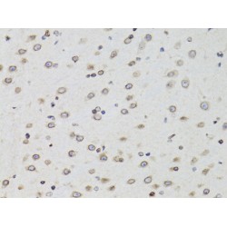 Thymopoietin (TMPO) Antibody