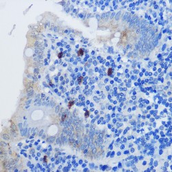 Interleukin 8 / IL8 (CXCL8) Antibody
