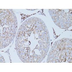 Integrin Beta III / CD61 (ITGB3) Antibody