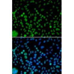 Interferon Regulatory Factor 2 (IRF2) Antibody