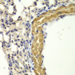 Protein Kinase, CGMP Dependent Type I (PRKG1) Antibody