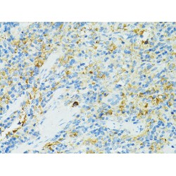 B-Lymphocyte Antigen CD19 (CD19) Antibody