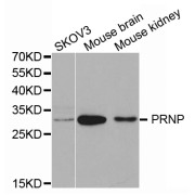 Western blot analysis of extracts of various cell lines, using PRNP antibody (abx002019) at 1/1000 dilution.