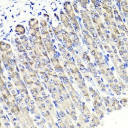 Mitogen-Activated Protein Kinase-Binding Protein 1 (MAPKBP1) Antibody