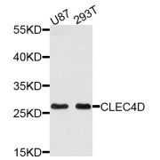 Western blot analysis of extracts of various cell lines, using CLEC4D antibody (abx002061) at 1/1000 dilution.