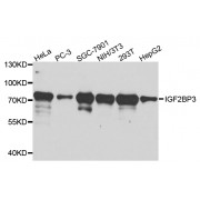 Western blot analysis of extracts of various cell lines, using IGF2BP3 antibody (abx002080) at 1/1000 dilution.