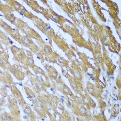 Insulin Like Growth Factor 2 mRNA Binding Protein 3 (IGF2BP3) Antibody