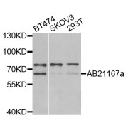 Western blot analysis of extracts of various cell lines, using PSMD3 antibody (abx002094) at 1:400 dilution.