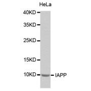 Western blot analysis of extracts of HeLa cells, using IAPP antibody (abx002102).