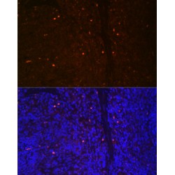 Runt-Related Transcription Factor 2 (RUNX2) Antibody