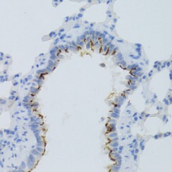 Prostaglandin E Receptor 2 (PTGER2) Antibody
