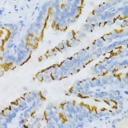 Prostaglandin E Receptor 2 (PTGER2) Antibody