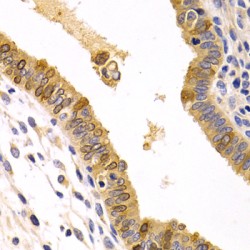 Chemokine C-X-C-Motif Receptor 3 (CXCR3) Antibody