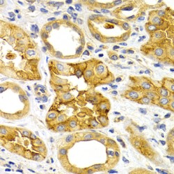 Chemokine C-X-C-Motif Receptor 3 (CXCR3) Antibody