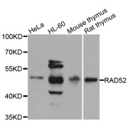 Western blot analysis of extracts of various cell lines, using RAD52 antibody (abx002218) at 1/1000 dilution.