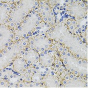 Immunohistochemistry of paraffin-embedded mouse kidney using SLC1A4 antibody (abx002221) (40x lens).