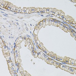 Neutral Amino Acid Transporter A (SLC1A4) Antibody