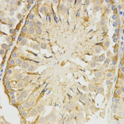 Tropomyosin Beta Chain (TPM2) Antibody