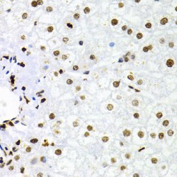 Nuclear Factor NF-Kappa-B P100 Subunit (NFKB2) Antibody