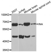 Western blot analysis of extracts of various cell lines, using INA antibody (abx002234) at 1:400 dilution.