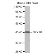 Western blot analysis of extracts of mouse fetal brain, using NPY1R antibody (abx002238).