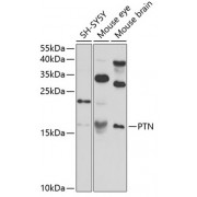 Western blot analysis of extracts of various cell lines, using PTN antibody (abx002245) at 1:400 dilution.