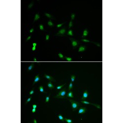 Piwi Like RNA-Mediated Gene Silencing 4 (PIWIL4) Antibody