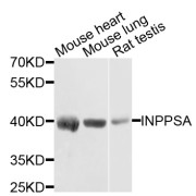 Western blot analysis of extracts of various cell lines, using INPP5A antibody (abx002349) at 1/1000 dilution.