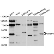 Western blot analysis of extracts of various cell lines, using WISP1 antibody (abx002388) at 1/1000 dilution.