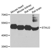 Western blot analysis of extracts of various cell lines, using STAU2 antibody (abx002447) at 1/1000 dilution.