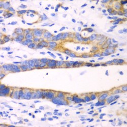 Acidic Mammalian Chitinase (CHIA) Antibody