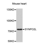 Western blot analysis of extracts of mouse heart, using SYNPO2L antibody (abx002526) at 1:3000 dilution.