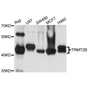 Western blot analysis of extracts of various cell lines, using TRMT2B antibody (abx002527) at 1/1000 dilution.