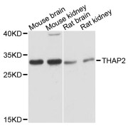 Western blot analysis of extracts of various cell lines, using THAP2 antibody (abx002534) at 1:3000 dilution.