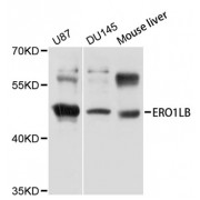 Western blot analysis of extracts of various cell lines, using ERO1LB antibody (abx002654) at 1/1000 dilution.